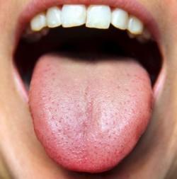 gezonde tong
